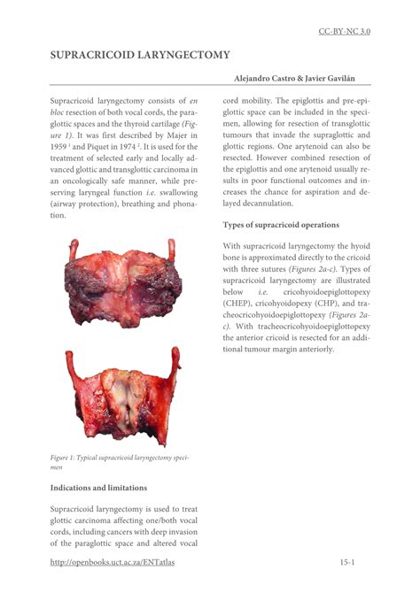 Supracricoid laryngectomy for laryngeal cancer .